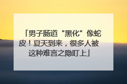 男子肠道“黑化”像蛇皮！夏天到来，很多人被这种难言之隐盯上